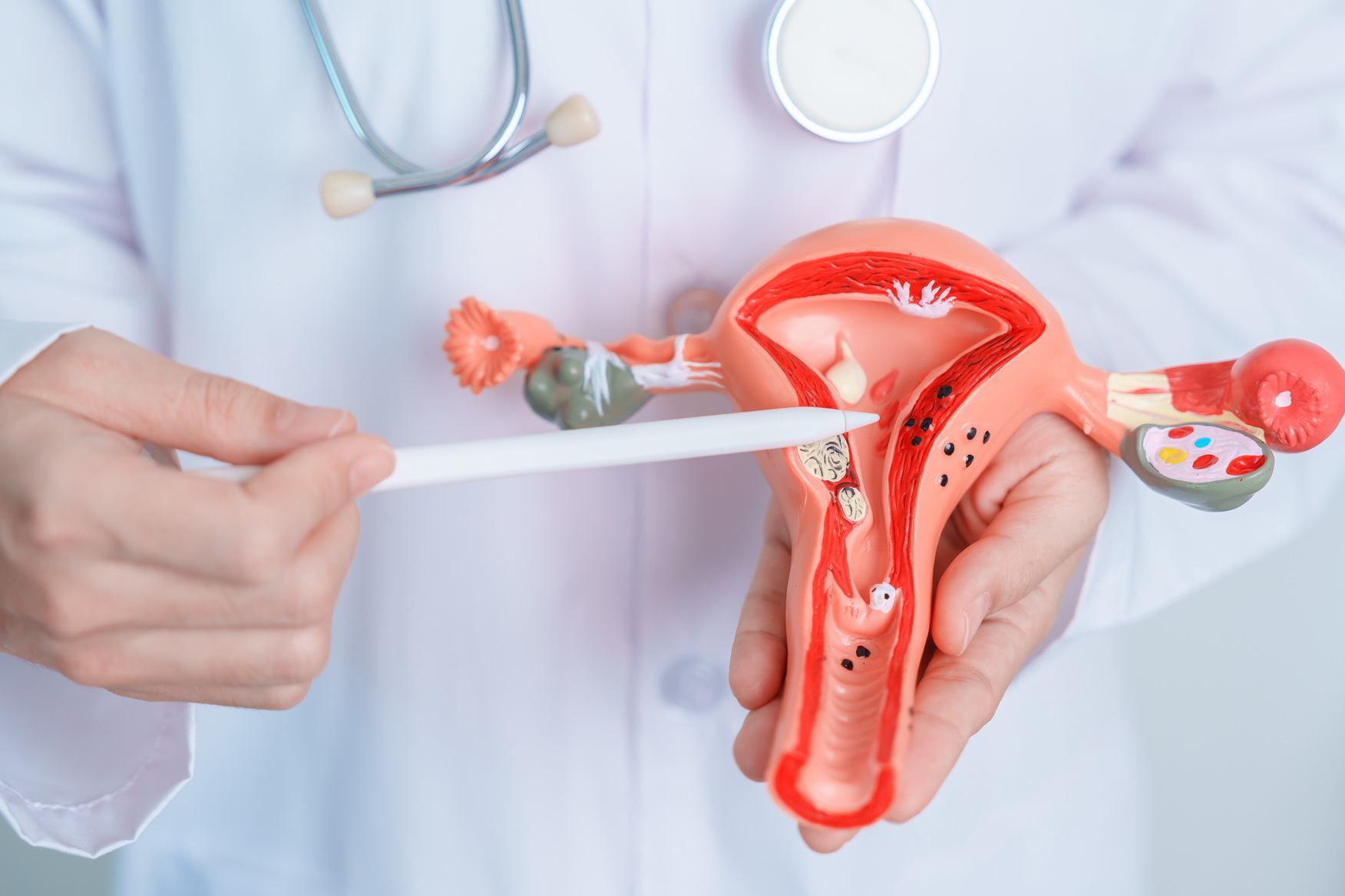hpv-vaccine-cervical-cancer-mortality-reduction